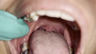 Intense uvula play with deep penetration and explicit close-ups